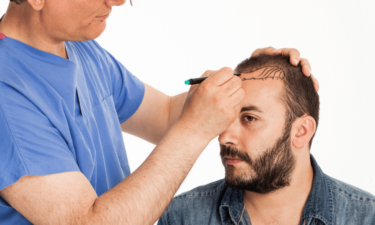 All You Need To Know on Stem Cell Hair Transplant New Jersey