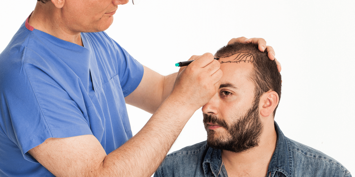 All You Need To Know on Stem Cell Hair Transplant New Jersey Hair Restoration Center